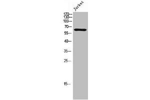 Western Blot analysis of Jurkat cells using Phospho-TIP60 (S86) Polyclonal Antibody (KAT5 抗体  (pSer86))