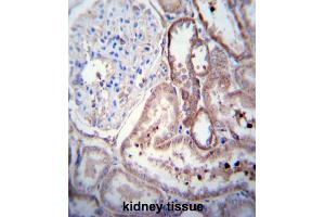 Immunohistochemical staining (Formalin-fixed paraffin-embedded sections) of human kidney tissue. (PDGFD 抗体  (AA 313-341))