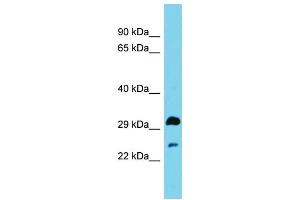Host: Rabbit Target Name: HSD17B13 Sample Type: Fetal Brain lysates Antibody Dilution: 1. (HSD17B13 抗体  (N-Term))