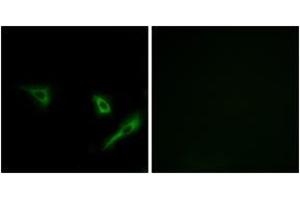 Immunofluorescence analysis of A549 cells, using ATG4A Antibody. (ATG4A 抗体  (AA 81-130))