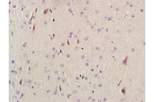 Paraformaldehyde-fixed, paraffin embedded mouse brain; Antigen retrieval by boiling in sodium citrate buffer (pH6. (AKAP12 抗体  (AA 701-900))