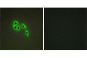 Immunofluorescence analysis of A549 cells, using DOK6 Antibody. (DOK6 抗体  (AA 111-160))
