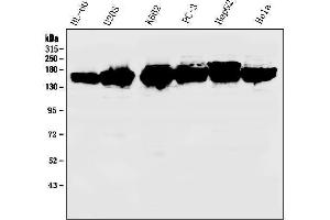Western blot analysis of KIF15 using anti-KIF15 antibody (ABIN6719385).