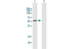 Western Blot analysis of ANXA11 expression in transfected 293T cell line by ANXA11 MaxPab polyclonal antibody. (Annexin A11 抗体  (AA 1-505))