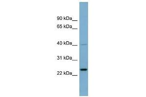 HSPC111 antibody used at 1 ug/ml to detect target protein. (NOP16 抗体  (Middle Region))