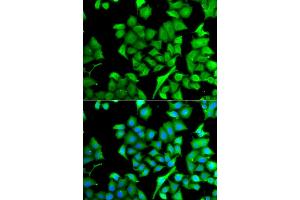 Immunofluorescence analysis of A549 cells using NAA50 antibody (ABIN5975518). (NAA50 抗体)