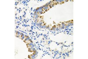 Immunohistochemistry of paraffin-embedded mouse lung using IRAK2 antibody (ABIN5971467) at dilution of 1/100 (40x lens). (IRAK2 抗体)