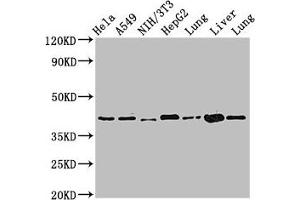Western Blot Positive WB detected in: Hela whole cell lysate, A549 whole cell lysate, NIH/3T3 whole cell lysate, HepG2 whole cell lysate, Rat lung tissue, Mouse liver tissue, Mouse lung tissue All lanes: ACAA2 antibody at 2. (ACAA2 抗体  (AA 188-257))