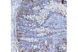 IHC analysis of BCMA using anti-BCMA antibody (ABIN5692956).