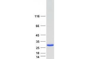 Western Blotting (WB) image for Mid1-Interacting Protein 1 (m1ip1) (Transcript Variant 2) protein (Myc-DYKDDDDK Tag) (ABIN2725993)