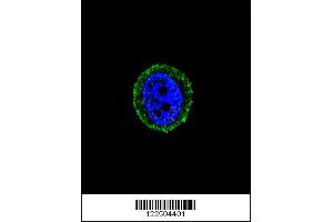 Confocal immunofluorescent analysis of CALCR Antibody with MCF-7 cell followed by Alexa Fluor 488-conjugated goat anti-rabbit lgG (green). (MICU1 抗体  (C-Term))