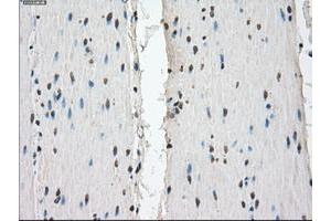 Image no. 8 for anti-Fc gamma RII (CD32) antibody (ABIN1497254) (Fc gamma RII (CD32) 抗体)