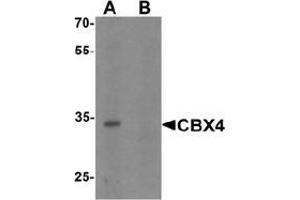 Western blot analysis of CBX4 in human brain tissue lysate with CBX4 Antibody  at 1 μg/ml in (A) the absence and (B) the presence of blocking peptide. (CBX4 抗体  (N-Term))