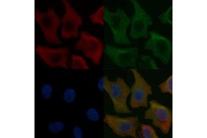 GUCA1A Mouse Monoclonal Antibody staining Hela cells by IF/ICC. (GCAP1 抗体)