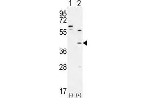 Western blot analysis of TGIF1 (arrow) using rabbit polyclonal TGIF1 Antibody (Center A160) . (TGIF1 抗体  (Middle Region))