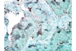 Immunohistochemistry analysis using Mouse Anti-Hsp90 Monoclonal Antibody, Clone 4F3. (HSP90 抗体  (PerCP))