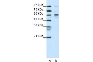 Western Blotting (WB) image for anti-General Transcription Factor IIF, Polypeptide 1, 74kDa (GTF2F1) (N-Term) antibody (ABIN2792594)