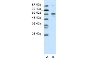 WB Suggested Anti-GTF2F1 Antibody Titration:  0. (GTF2F1 抗体  (N-Term))