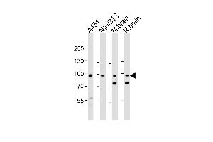 Western blot analysis of lysates from A431, mouse NIH/3T3 cell line, mouse brain, rat brain tissue lysate(from left to right), using Ephb1 Antibody (Center) (ABIN6243653 and ABIN6577762). (EPH Receptor B1 抗体  (AA 374-409))
