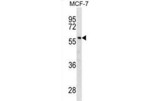 Western Blotting (WB) image for anti-Gc antibody (ABIN2930430) (Gc 抗体)
