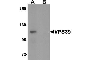 Western Blotting (WB) image for anti-Vacuolar Protein Sorting 39 Homolog (VPS39) (C-Term) antibody (ABIN1030796) (VPS39 抗体  (C-Term))