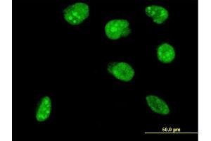 Immunofluorescence of monoclonal antibody to NHLH2 on HeLa cell. (NHLH2 抗体  (AA 36-135))