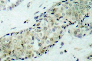 Image no. 1 for anti-Histone Deacetylase 5 (HDAC5) antibody (ABIN265457) (HDAC5 抗体)