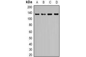 Western blot analysis of EGF expression in K562 (A), Hela (B), HEK293T (C), NIH3T3 (D) whole cell lysates. (EGF 抗体)