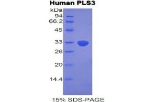 SDS-PAGE analysis of Human Plastin 3 Protein. (Plastin 3 Protein (PLS3))