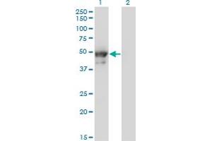 Western Blot analysis of KRT8 expression in transfected 293T cell line by KRT8 monoclonal antibody (M02), clone 3E3. (KRT8 抗体  (AA 91-195))
