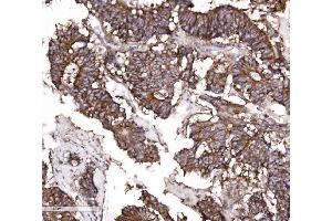 IHC analysis of Claudin 3/CLDN3 using anti-Claudin 3/CLDN3 antibody (ABIN7599626). (Claudin 3 抗体  (AA 101-220))