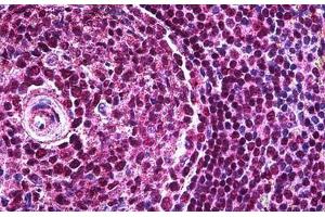 Human Spleen: Formalin-Fixed, Paraffin-Embedded (FFPE) (PAX5 抗体  (AA 192-302))