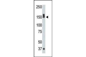 The DK1 polyclonal antibody 7217b is used in Western blot to detect DK1 in mouse liver tissue lysate. (DAP Kinase 1 抗体  (C-Term))