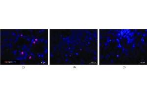 Immunofluorescence microscopy to examine the morphologies of cells from retinal organoids after exposure to immunosuppressants (a) Axons in the control group were long and strong and most expressed tubulin and NEFL (detected via immunofluorescence staining) indicating that the cells in this group could develop mature axons. (Ki-67 抗体  (AA 700-800))