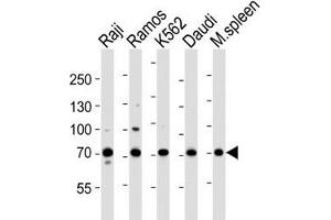Western blot analysis of lysate from Raji, Ramos, K562, Daudi cell line and mouse spleen tissue lysate using BTK antibody at 1:1000. (BTK 抗体  (AA 396-430))
