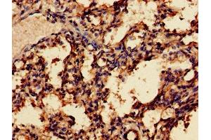 Immunohistochemistry of paraffin-embedded human lung tissue using ABIN7159273 at dilution of 1:100 (MAGEA8 抗体  (AA 1-270))