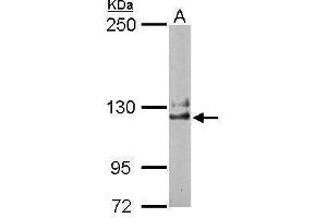 WB Image Sample (50 ug of whole cell lysate) A: Mouse brain 5% SDS PAGE antibody diluted at 1:1000 (NCKAP1 抗体)