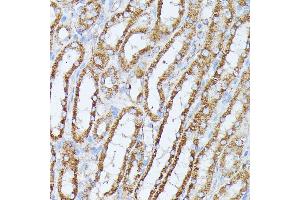Immunohistochemistry of paraffin-embedded mouse kidney using PP2A Catalytic β antibody (ABIN3023492, ABIN3023493, ABIN3023494 and ABIN6220084) at dilution of 1:100 (40x lens). (PPP2CB 抗体  (AA 1-309))