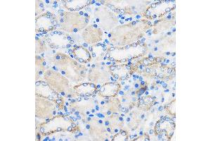 Immunohistochemistry of paraffin-embedded Rat kidney using R Rabbit pAb (ABIN6131585, ABIN6146704, ABIN6146705 and ABIN6222716) at dilution of 1:50 (40x lens).