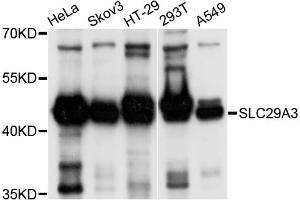 Western blot analysis of extracts of various cell lines, using SLC29A3 antibody (ABIN4905193) at 1:1000 dilution. (SLC29A3 抗体)