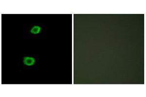 Immunofluorescence (IF) image for anti-Lemur tyrosine Kinase 2 (LMTK2) (Internal Region) antibody (ABIN1849763) (LMTK2 抗体  (Internal Region))