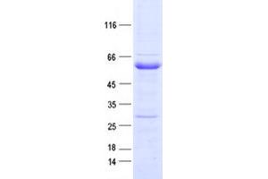 Western Blotting (WB) image for EPH Receptor B4 (EPHB4) protein (DYKDDDDK Tag) (ABIN2720253)