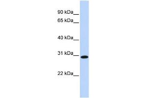 WB Suggested Anti-SMNDC1 Antibody Titration:  0. (SMNDC1 抗体  (Middle Region))