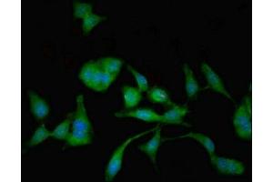 Immunofluorescent analysis of Hela cells using ABIN7143903 at dilution of 1:100 and Alexa Fluor 488-congugated AffiniPure Goat Anti-Rabbit IgG(H+L) (MAN2C1 抗体  (AA 746-969))