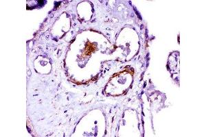 IHC-P: ACE antibody testing of human placenta tissue (Angiotensin I Converting Enzyme 1 抗体  (Middle Region))