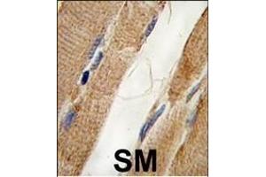 Formalin-fixed and paraffin-embedded human skeletal muscle tissue reacted with PI3KC3 Antibody , which was peroxidase-conjugated to the secondary antibody, followed by DAB staining. (PIK3C3 抗体  (AA 405-430))