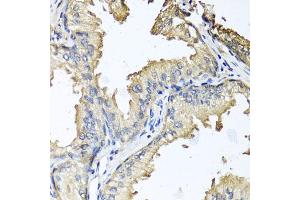Immunohistochemistry of paraffin-embedded human prostate using CXCR4 antibody (ABIN6292854) at dilution of 1:100 (40x lens). (CXCR4 抗体)