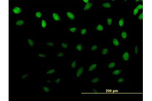 Immunofluorescence of purified MaxPab antibody to ZNF643 on HeLa cell.