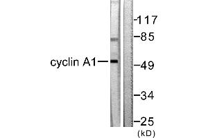Western blot analysis of extracts from SKOV3 cells, using Cyclin A1 antibody (#C0166). (Cyclin A1 抗体)