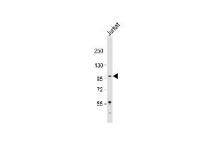Anti-LARGE Antibody (Center) at 1:2000 dilution + Jurkat whole cell lysate Lysates/proteins at 20 μg per lane. (LARGE 抗体  (AA 365-398))